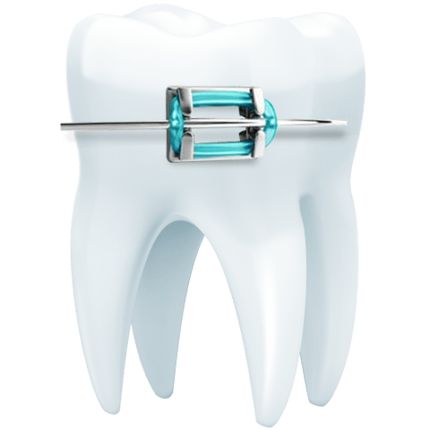 Dentistas en Puebla Grupo Odontológico Especializado